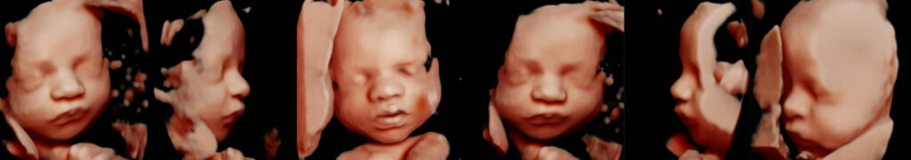 Visage en 3D d'un foetus